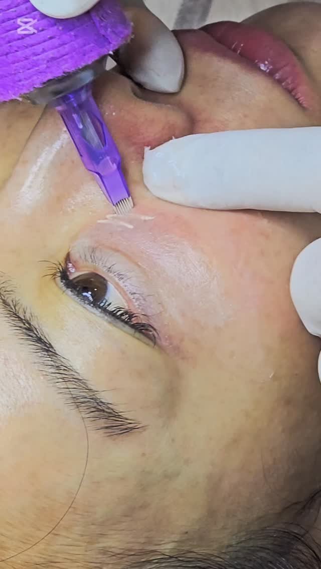 skinbeauty__101 게시물 이미지: 어떤 부위가 가장 신경 쓰이세요? 
원하시는 느낌이나 톤도 함께 말씀해주시면 상담이...
