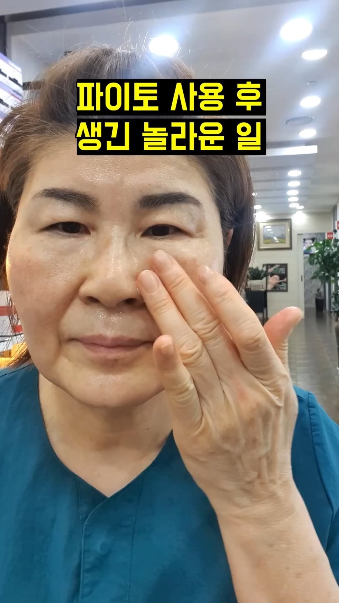 skinsaerona 게시물 이미지: 👀파이토 사용 후 생긴 놀라운 일

비비크림...