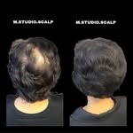 m_studio_scalp 프로필 사진