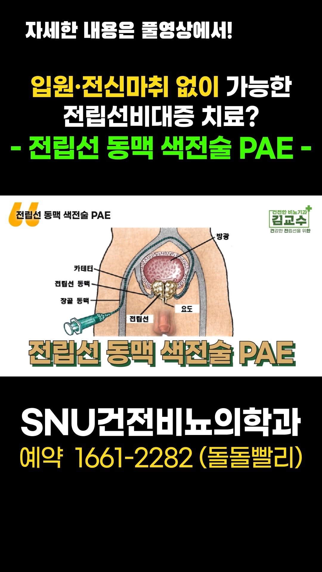 snu_urology 게시물 이미지: 입원·전신마취 없이 가능한 전립선비대증 치료? -전립선 동맥 색전술 PAE-...