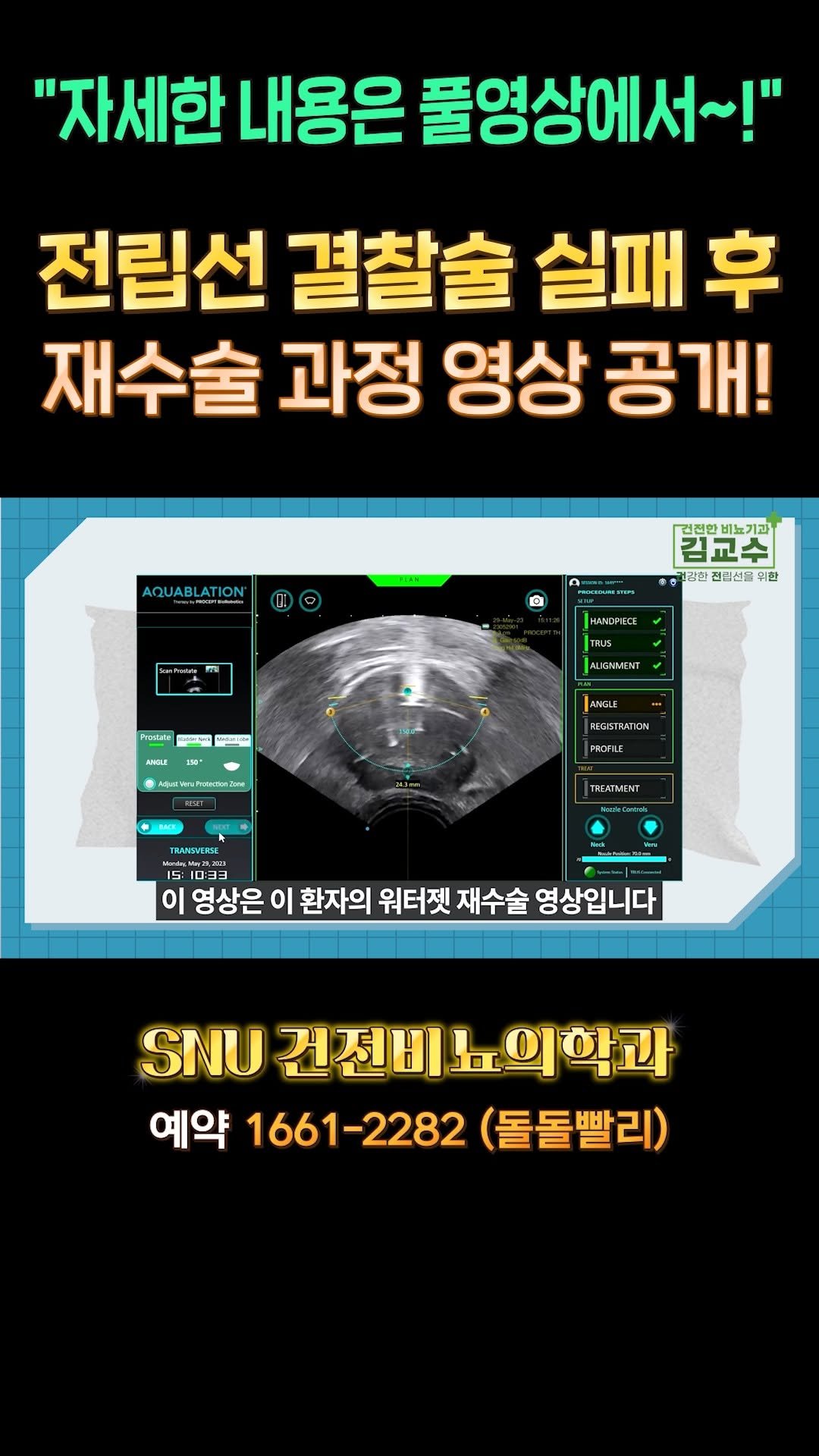 snu_urology 게시물 이미지: 전립선 결찰술 실패 후 재수술 영상 공개! 

🚊건대입구역 1번 출구 직통연결
☎️...