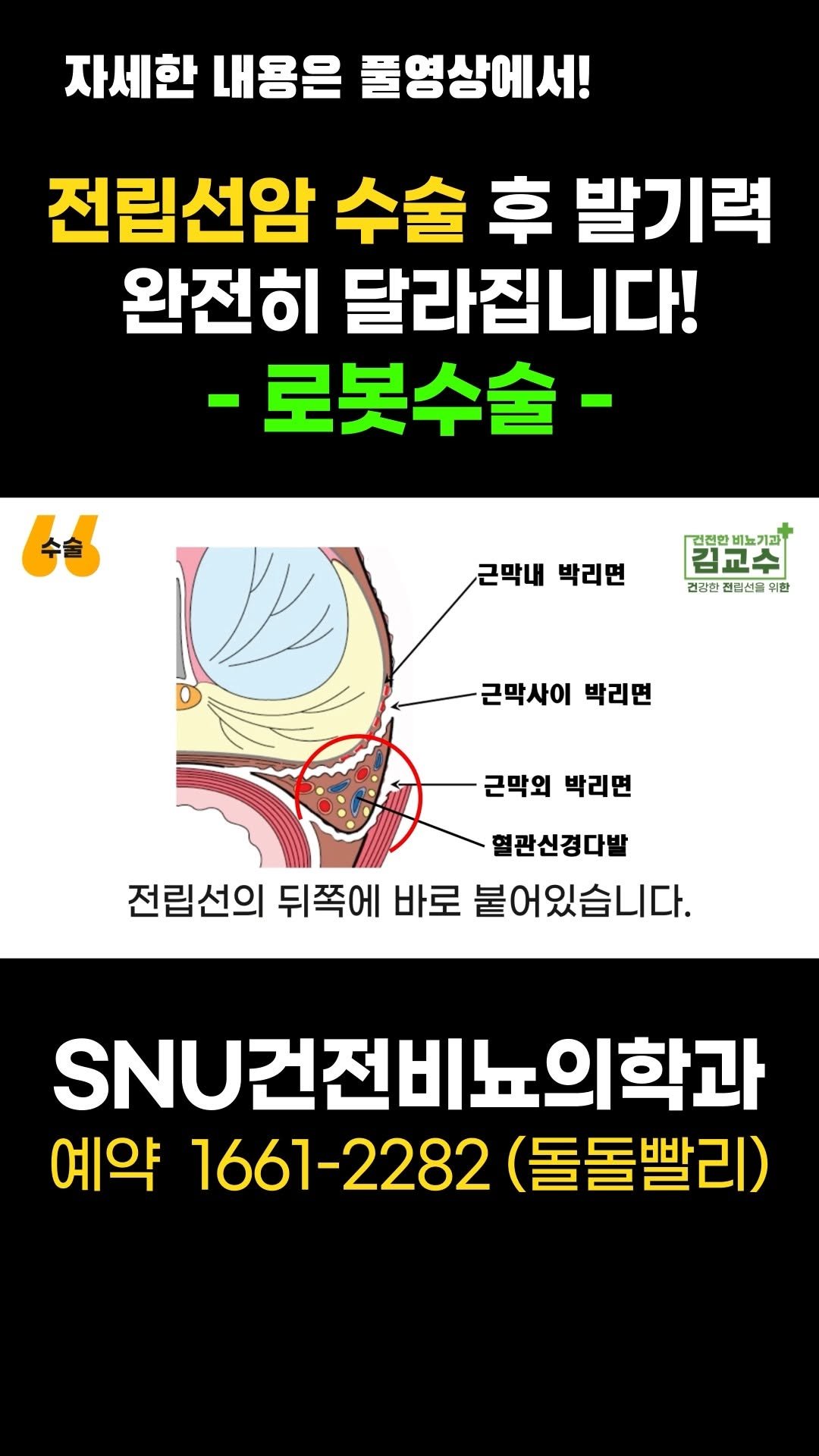 snu_urology 게시물 이미지: 전립선암 수술 후 발기력, 완전히 달라집니다! -로봇수술- 
#전립선암...