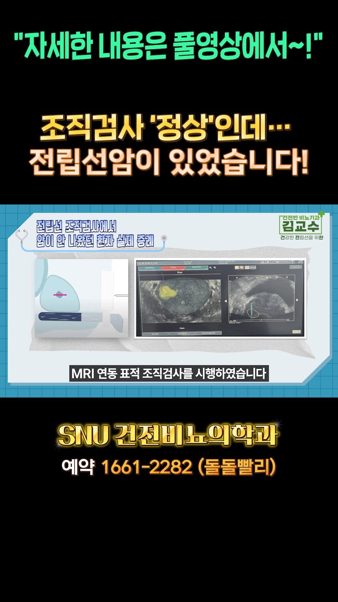 snu_urology 게시물 이미지: 조직검사 '정상'인데...전립선암이 있었습니다! 
#전립선암 
#전립선mri...