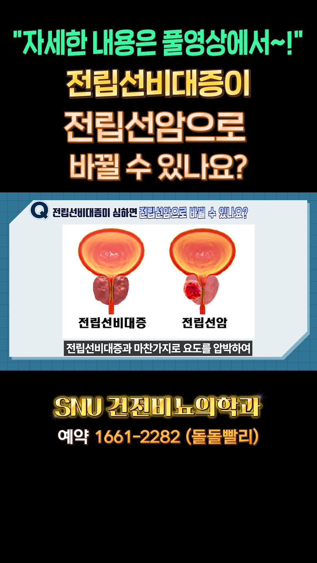 snu_urology 게시물 이미지: 전립선비대증이 전립선암으로 바뀔 수 있나요? 
#전립선비대증 
#전립선비대증상...