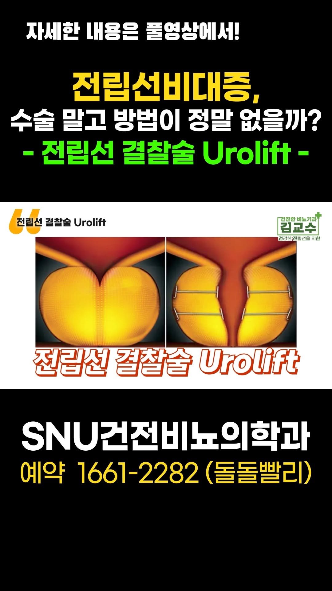 snu_urology 게시물 이미지: 전립선비대증, 수술 말고 방법이 정말 없을까? -전립선 결찰술 Urolift-...
