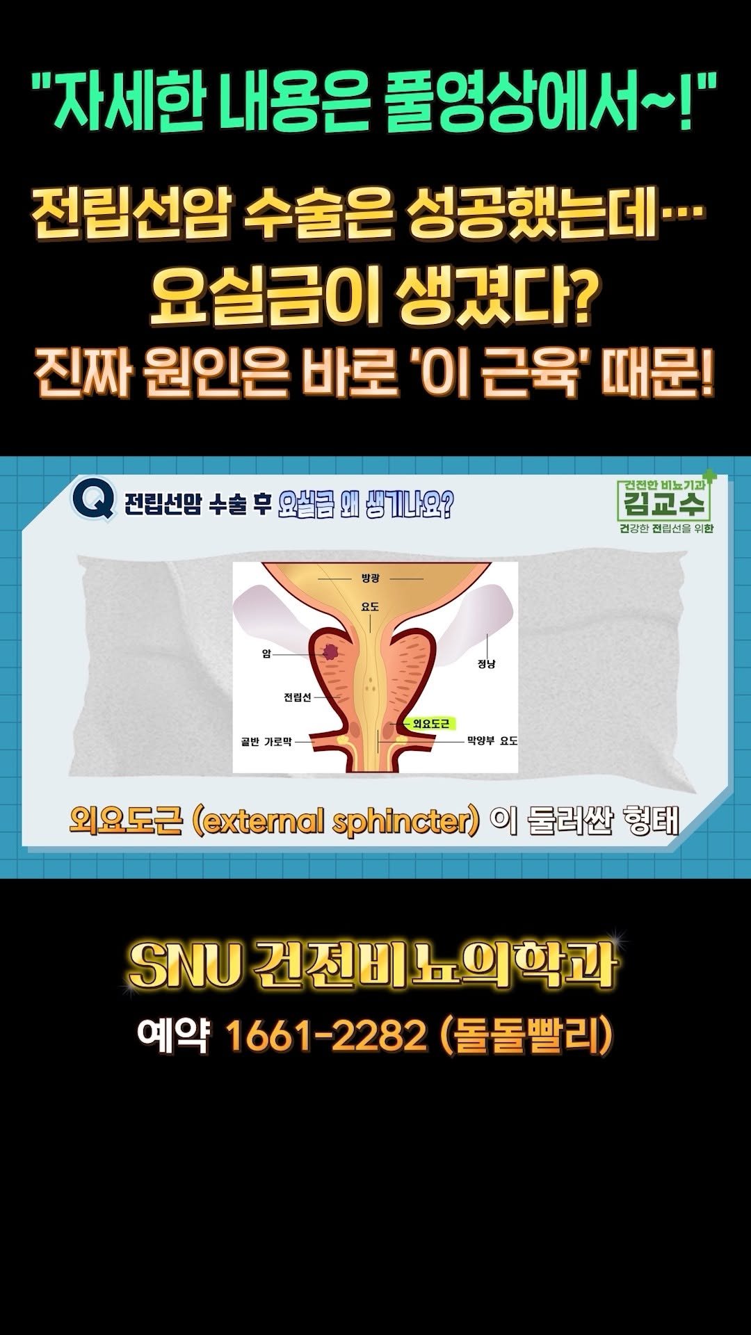 snu_urology 게시물 이미지: 전립선암 수술은 성공했는데… 요실금이 생겼다? 진짜 원인은 바로 ‘이 근육’ 때문!...