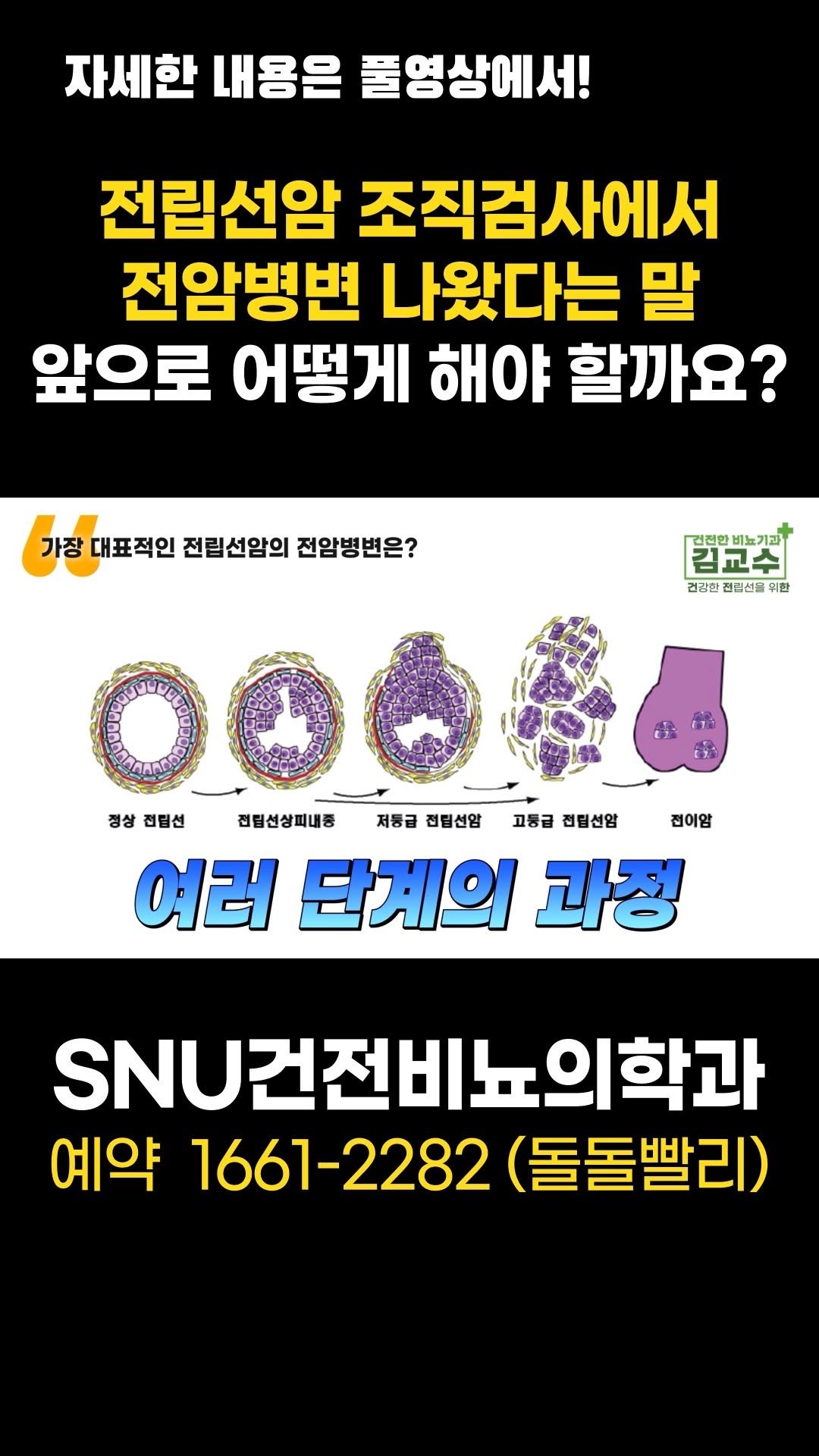 snu_urology 게시물 이미지: 전립선암 조직검사에서 전암병변 나왔다는 말... 앞으로 어떻게 해야...