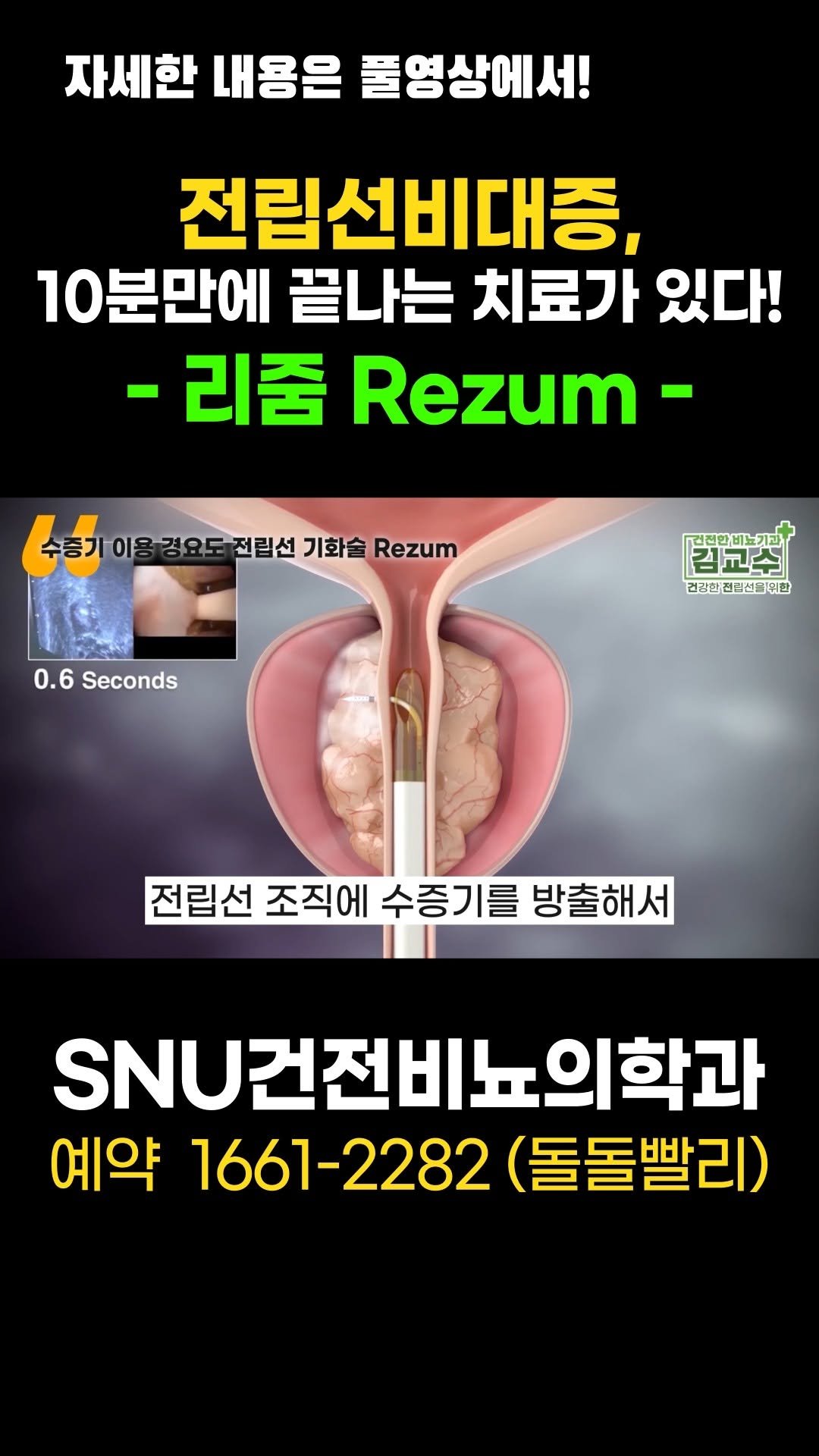 snu_urology 게시물 이미지: 전립선비대증, 10분만에 끝나는 치료가 있다! 리줌-Rezum 
#전립선비대증...