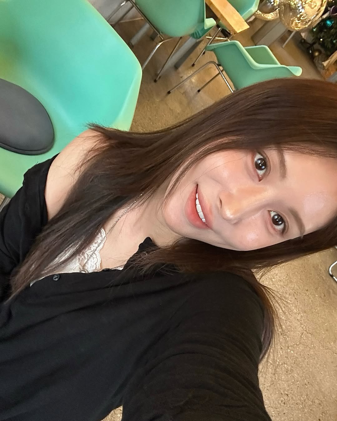 so1jii 게시물 이미지: (내돈내산) 부분교정+라미 찐후기🦷
웃을 때마다 치아가 신경 쓰였는데
1년 넘게...