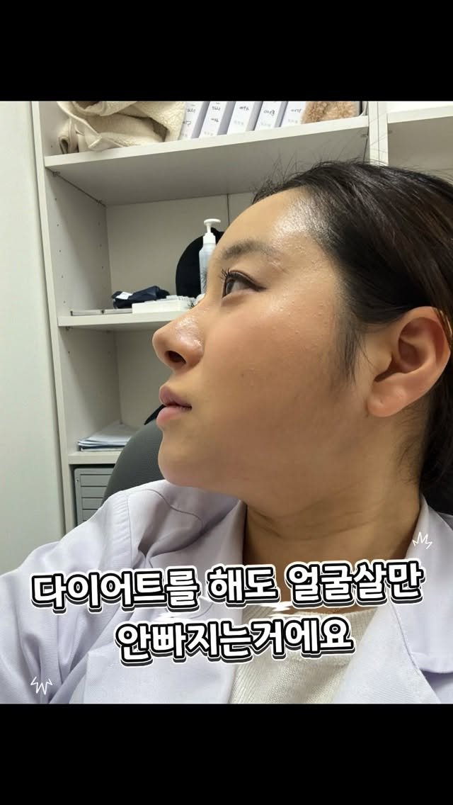 soiy__11 게시물 이미지: #협찬 30대 되니까 진짜 얼굴 라인이 예전 같지 않더라구요🥹
다이어트해도 이중턱은...