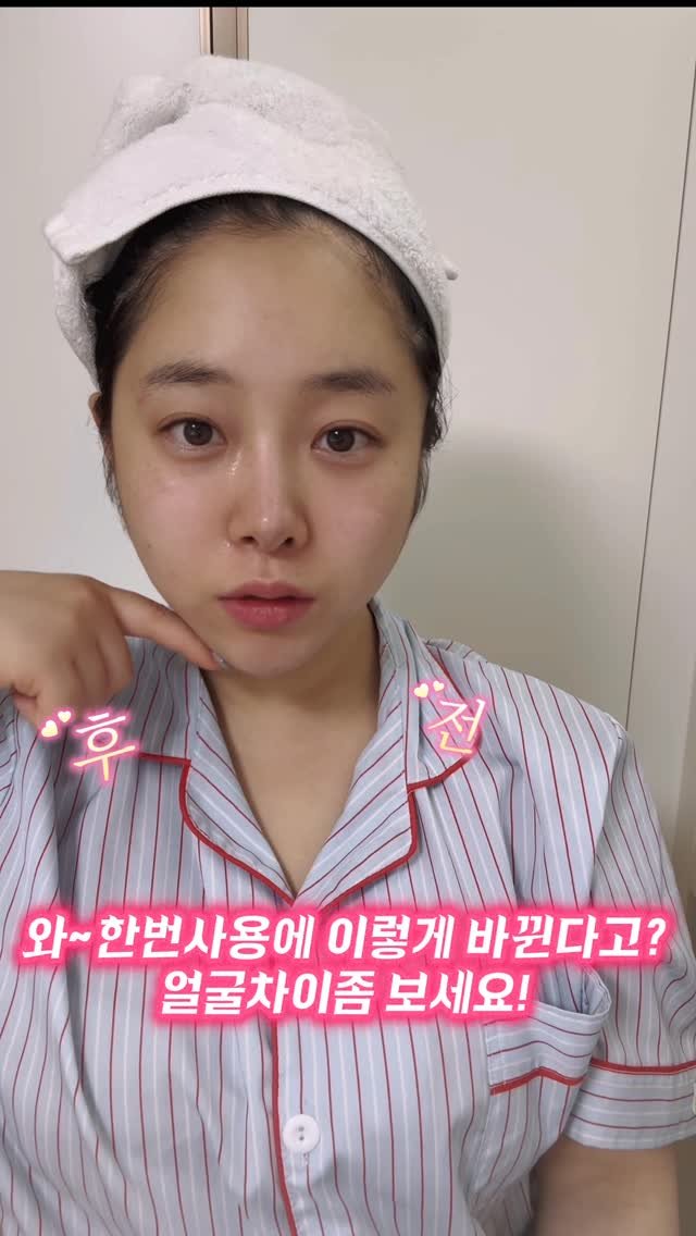 soiy__11 게시물 이미지: #협찬 30대 넘으니까 턱선 무너지고 심부볼, 이중턱은 왜 이렇게 안 빠지는지...