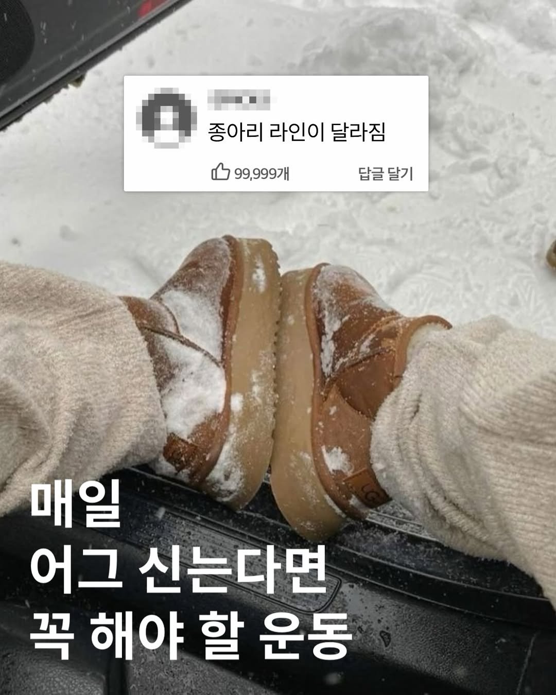 sojoy.kim 게시물 이미지: 매일 어그를 신으면, 다리가 퉁퉁 붓고 라인이 안 예뻐져요
= 종아리가 과로할...