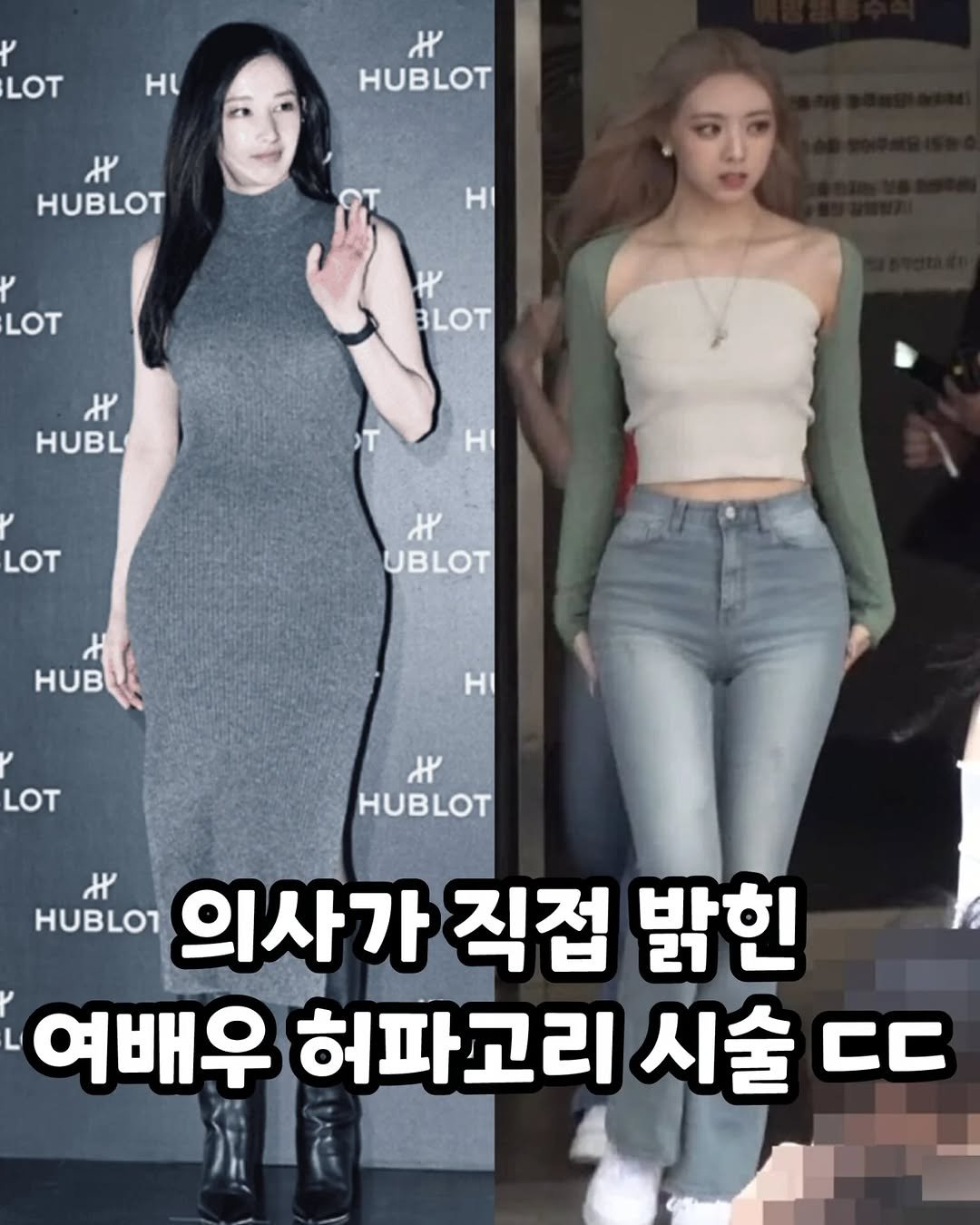 some2lve 게시물 이미지: 요즘 난리났다는 스트레팅템 ㄷㄷㄷ
.
.
#연예이슈 #관리템 #후기 #아이돌