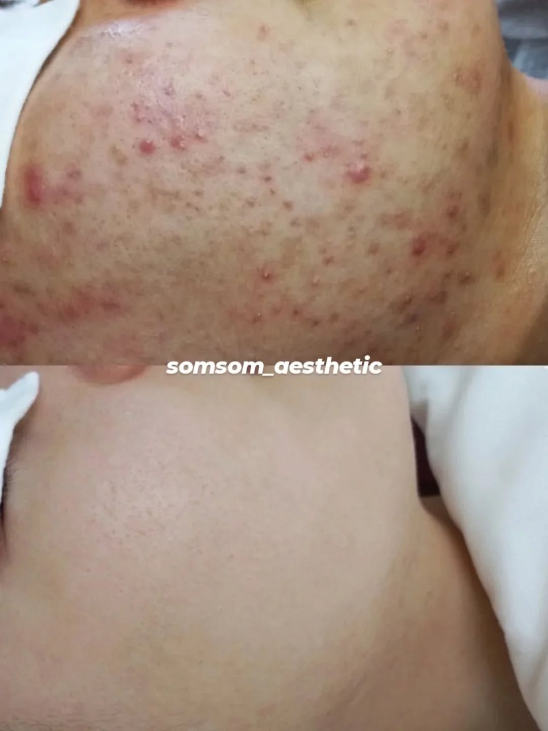 somsom_aesthetic 게시물 이미지: "원장님, 다른 곳 갔더니 제 피부 설명은 안 해주고
 회원권 결제 얘기만 해서...