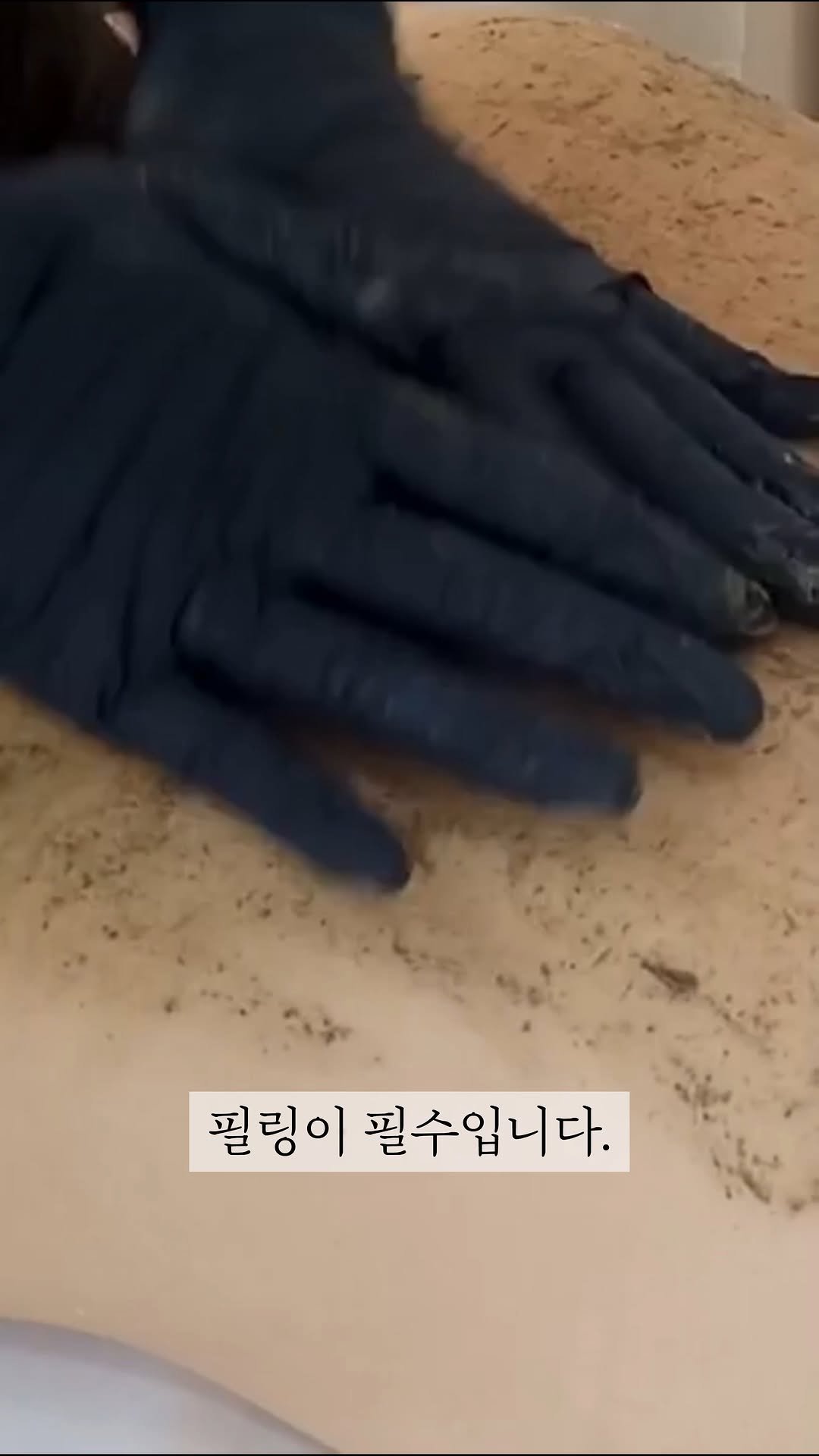 somsom_aesthetic 게시물 이미지: 등여드름 때문에 망설이고 계시나요?"

원래 등피부는 얼굴보다 층이 
두껍고 재생이...