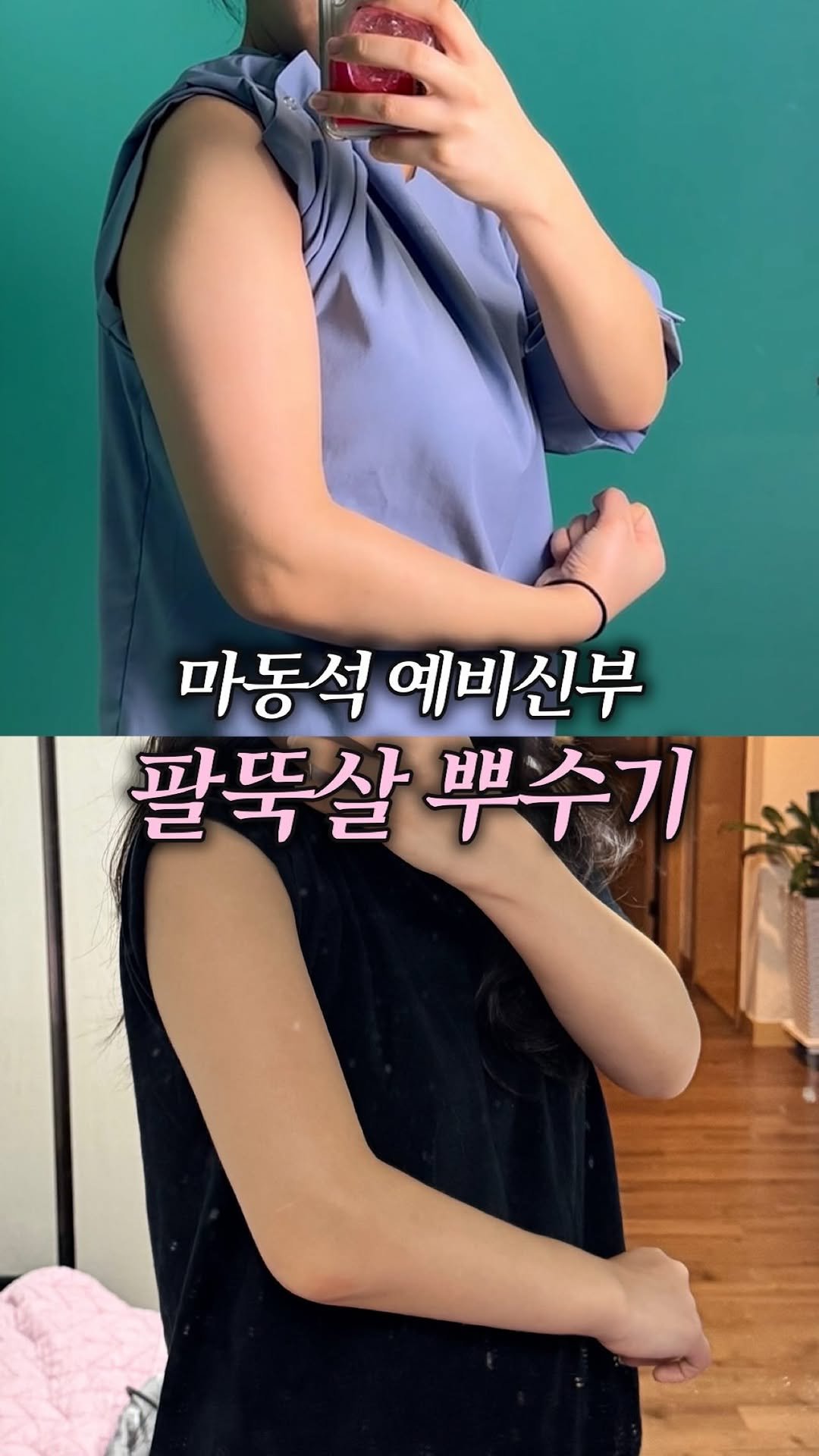 soonseo.bbu 게시물 이미지: 예비신부들의 최대고민.... 팔뚝살 없애고 왔어요!!!!

제가 진짜 마동석...