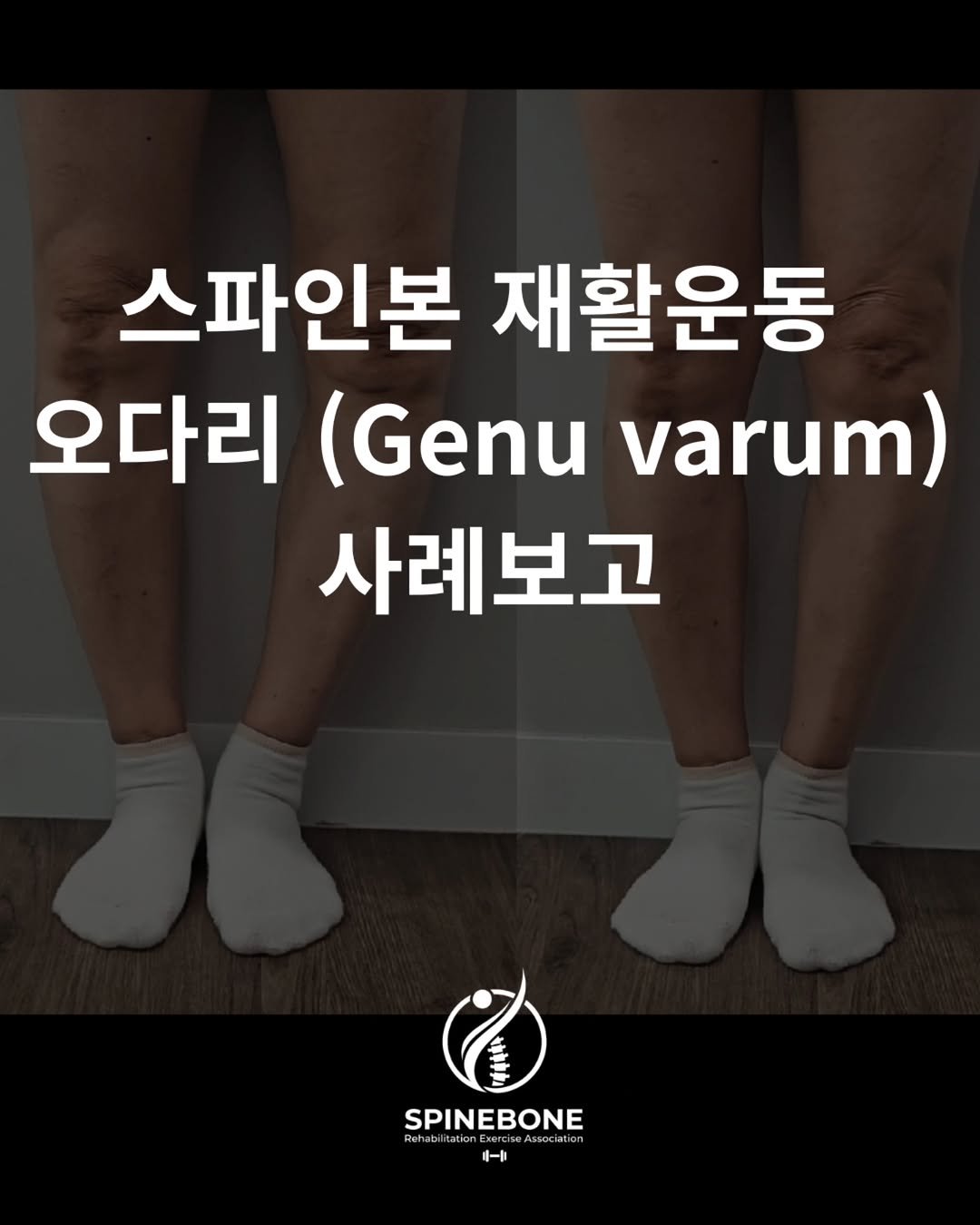 spine_bone_ 게시물 이미지: 무릎을 정면으로 맞춰보세요.

그 한 동작이 운동 처방의 방향을...