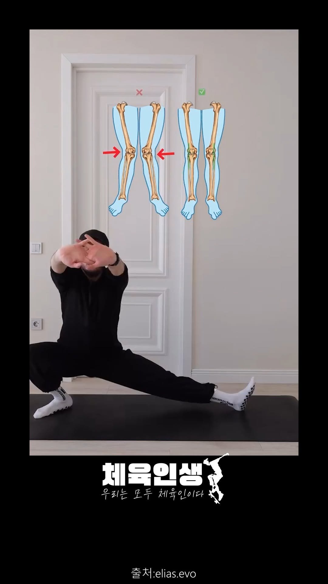 sports_l_i_f_e_ 게시물 이미지: 📌 무릎이 안쪽/바깥쪽으로 틀어지나요?

다리 라인을 바로 잡는 핵심 3가지 운동...