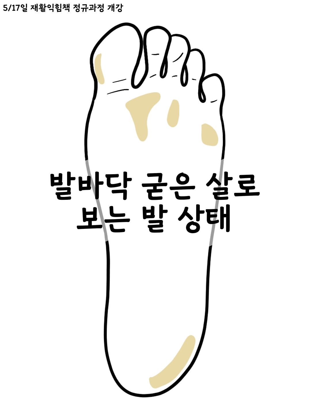 sportsmedilin 게시물 이미지: -
조그마한 주제에 뼈도 엄청 많고, 관절도 엄청 많고,
움직임도 다른 관절들과...
