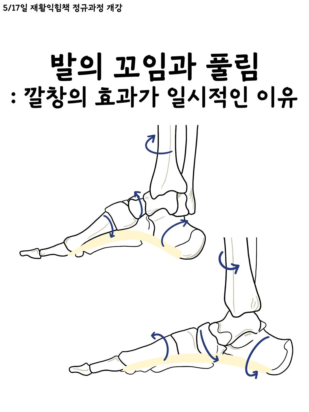 sportsmedilin 게시물 이미지: 해도해도 복잡한
발 움직임, 올바른 평가방법과 그에 따른 운동법이
궁금하다면,...