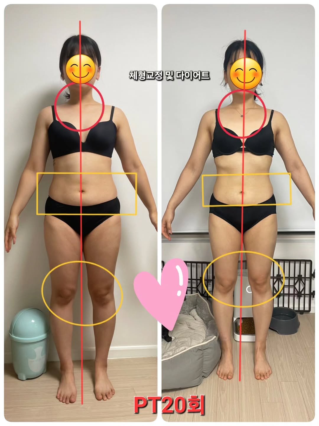 sso_oah 게시물 이미지: 비포 애프터

세상에는
열심히 한다고 모두 원하는 결과를 얻을 수 있는 건 아닌거...