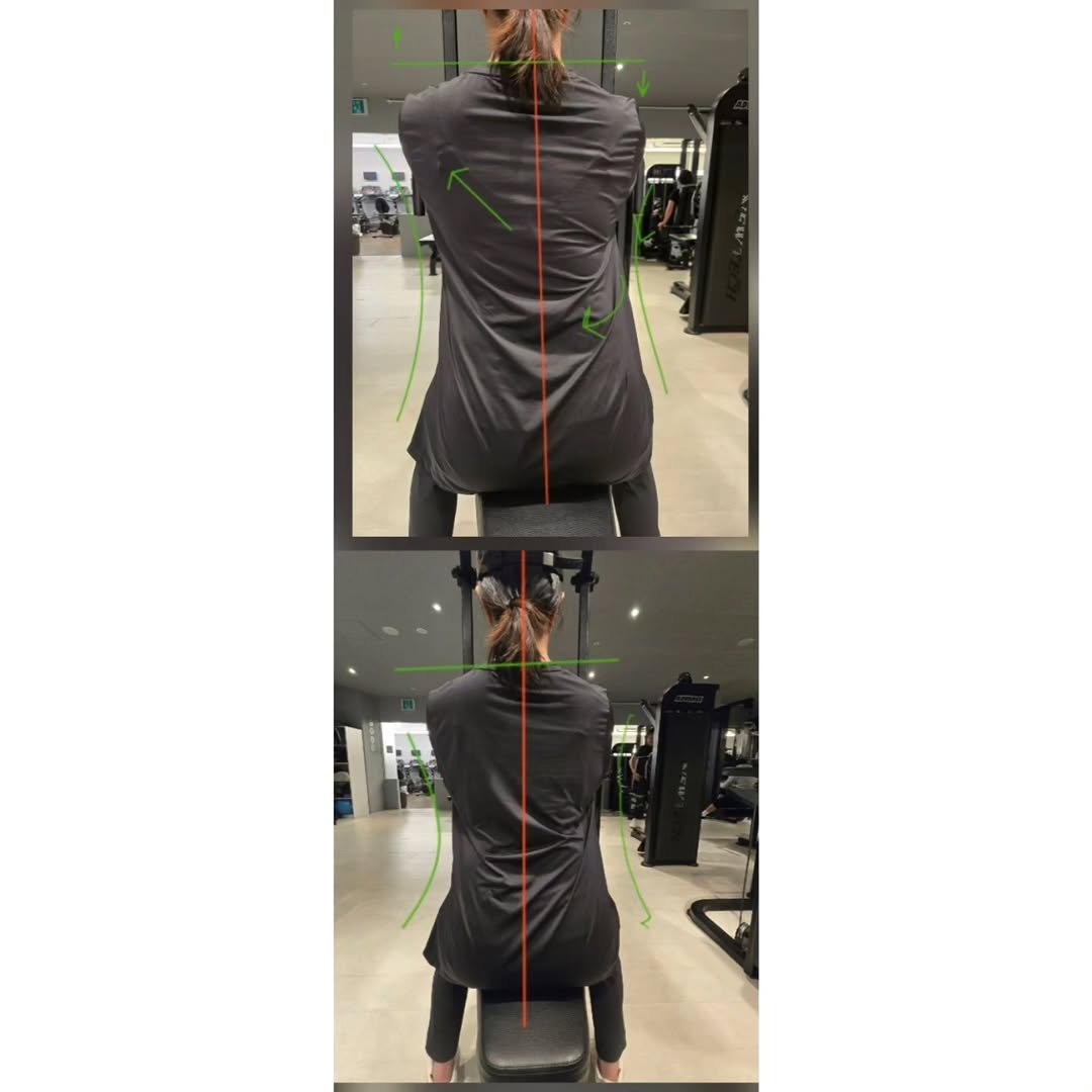 sso_oah 게시물 이미지: 운동 중 촬영한 영상을 캡쳐한 사진 입니다.

rear deltoid 머신에서
제게...