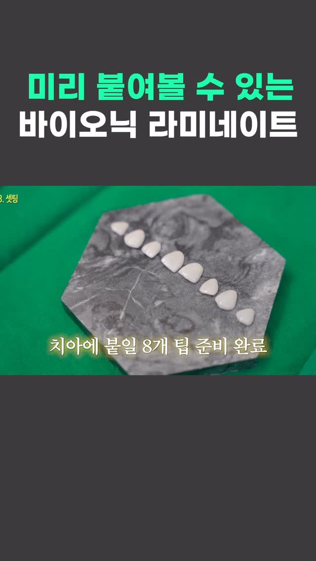standard__dental 게시물 이미지: 라미네이트 하기 전에 먼저 붙여볼 수 있다면? 👀

완성 후 모습을 미리...