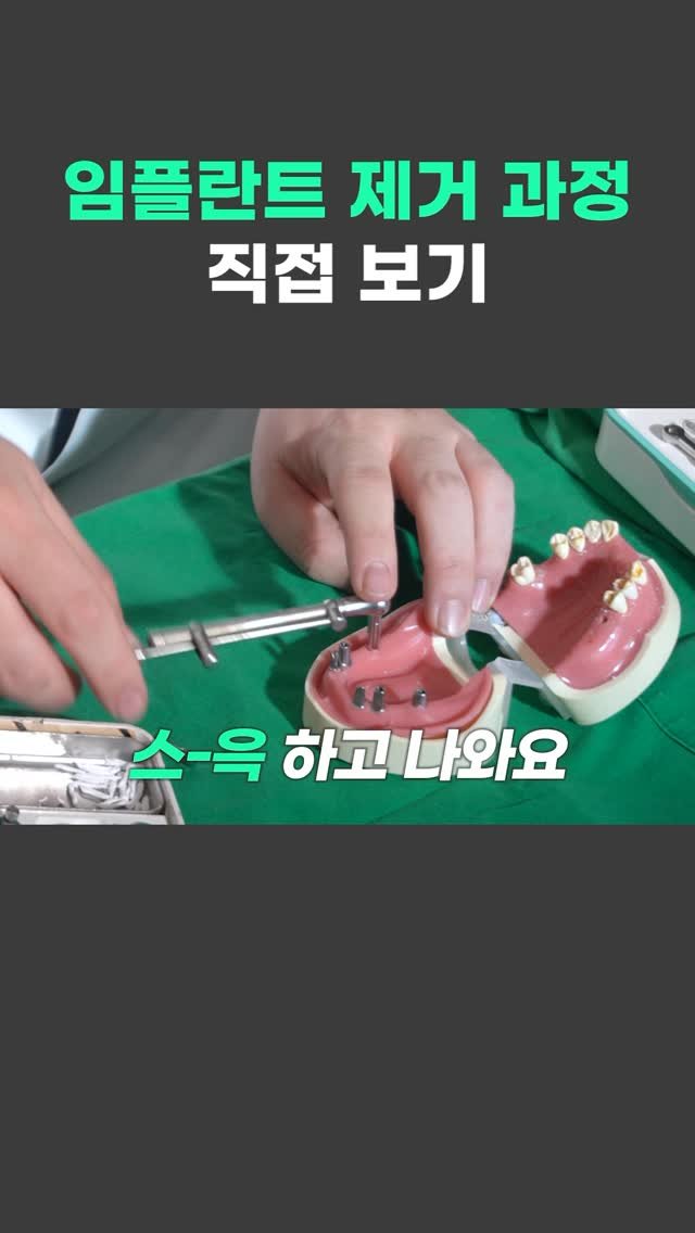 standard__dental 게시물 이미지: 임플란트 제거 과정 궁금하지 않으셨나요~?
모형으로 직접 보는 제거 과정 공개!!✨