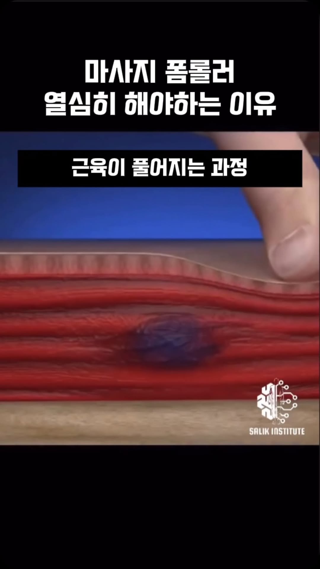 stretch_storage 게시물 이미지: 근육 이러한 원리로 풀리는구나..
(실제로는 영상처럼 풀리지는 않습니다 재미로만...
