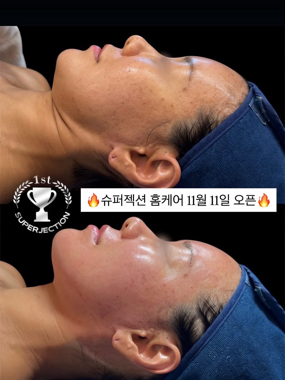 Photo by 노화방지 𝑵𝒐.𝟏 「 스뮤즈 」 • 1:1 맞춤 홈케어 코칭 • 창원슈퍼젝션 전문점 on October 30, 2025. May be an image of ‎text that says '‎د SUPER SUPERJECTION CTION 슈퍼젝션 홈케어 11월 11일 오픈‎'‎.