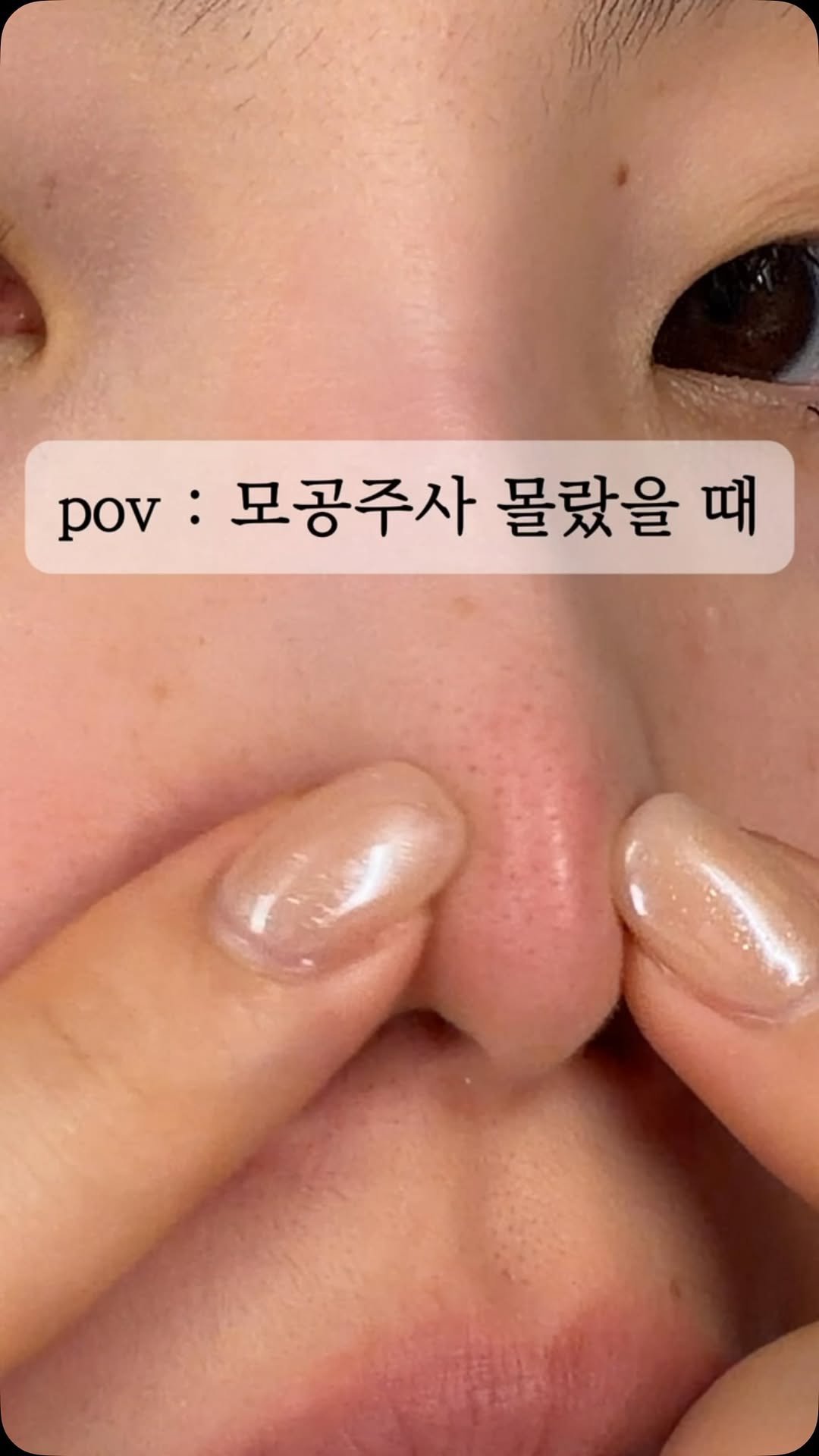 studio.m_u_s_e 게시물 이미지: 대기 인원만 1,000명 돌파!!! 🔥
모공성형 슈젝홈 4회분 10만 원대...