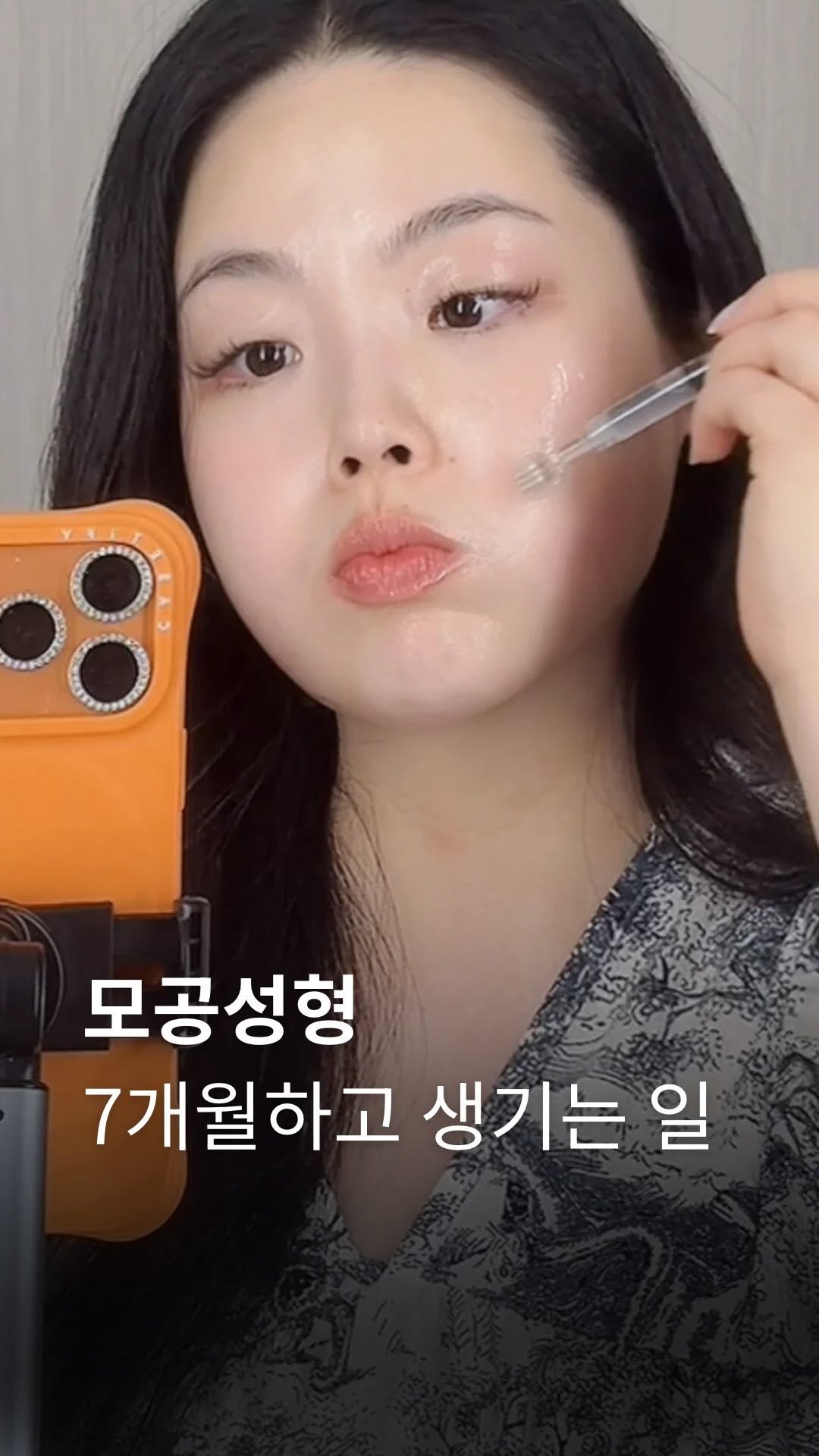 studio.m_u_s_e 게시물 이미지: 다시 봐도 충격인 작년 제 모공
근데 지금은 확실히 쫀쫀해졌어요
(작년 예신 관리로...