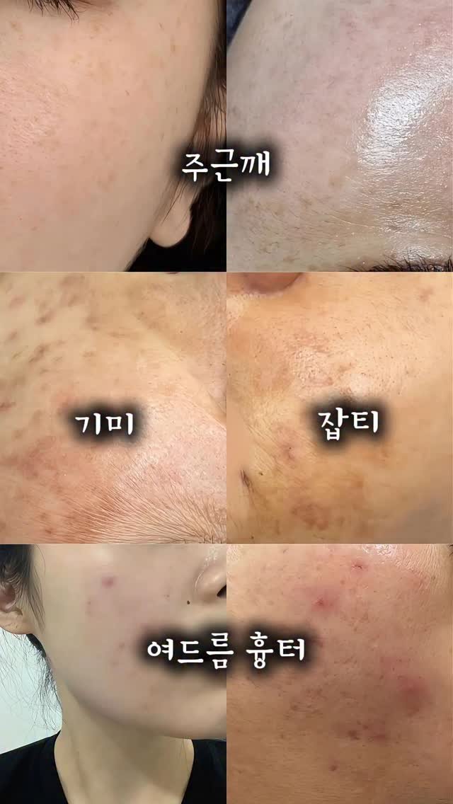 studio.m_u_s_e 게시물 이미지: 혹시 내 얘기 같다구요?!

✔ 뭘 해도 안 사라지는 기미·잡티
✔ 얼룩덜룩...