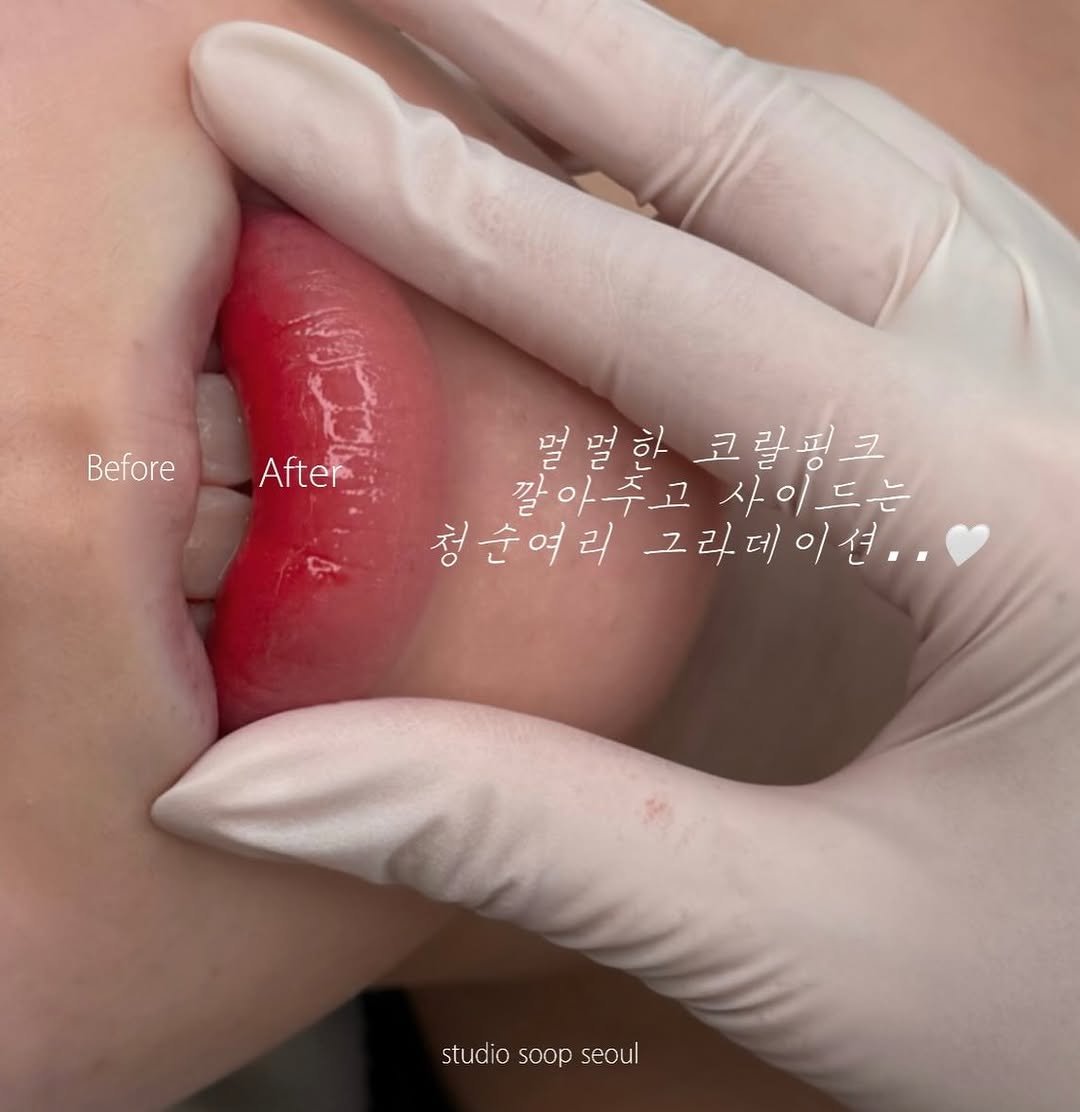 Photo by 스튜디오 숲 서울ㅣ대표원장 아인ㅣ자연눈썹의 미학, 자연흐름결 개발, 애교살반영구, 강남반영구 전문 in Cheongdam-dong. May be an image of one or more people, lipstick and text that says 'BeforeAfter After Before 멀멀하코림핑그 멀멀한 코랄핑크 깔아주고 사이드는 청순여리 순여리그리데이션.. 그리데이션.. studio soop studiosoopseoul seoul'.