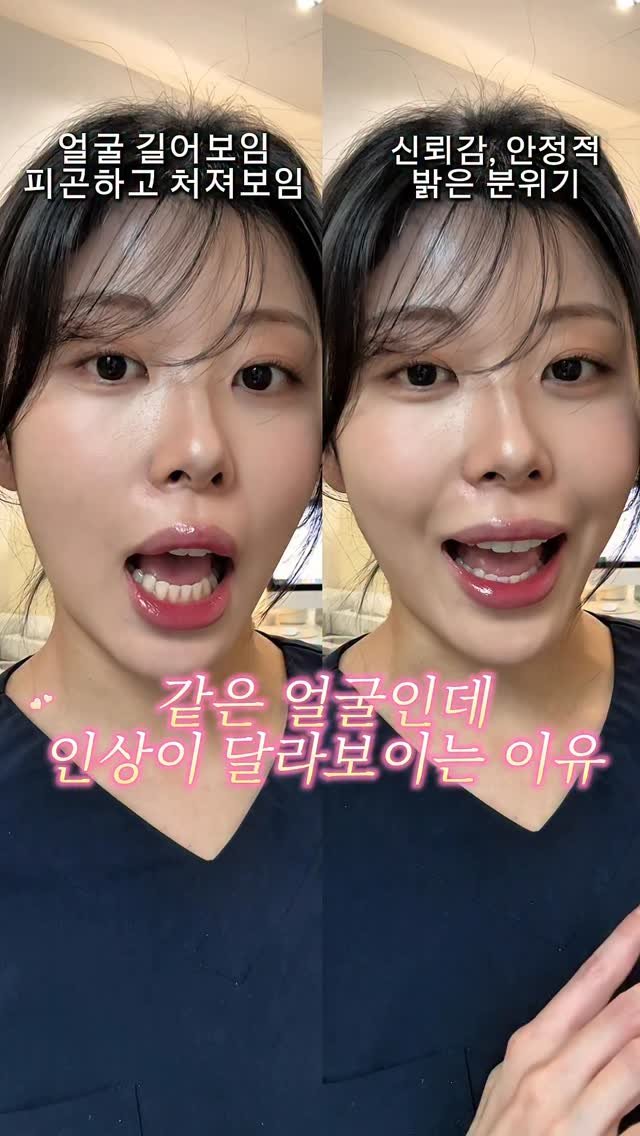 su_face.sua 게시물 이미지: 대부분 모르는 얼굴 비율 망치는 습관, 바로 '아래 입술 내리기' 입니다

특히...