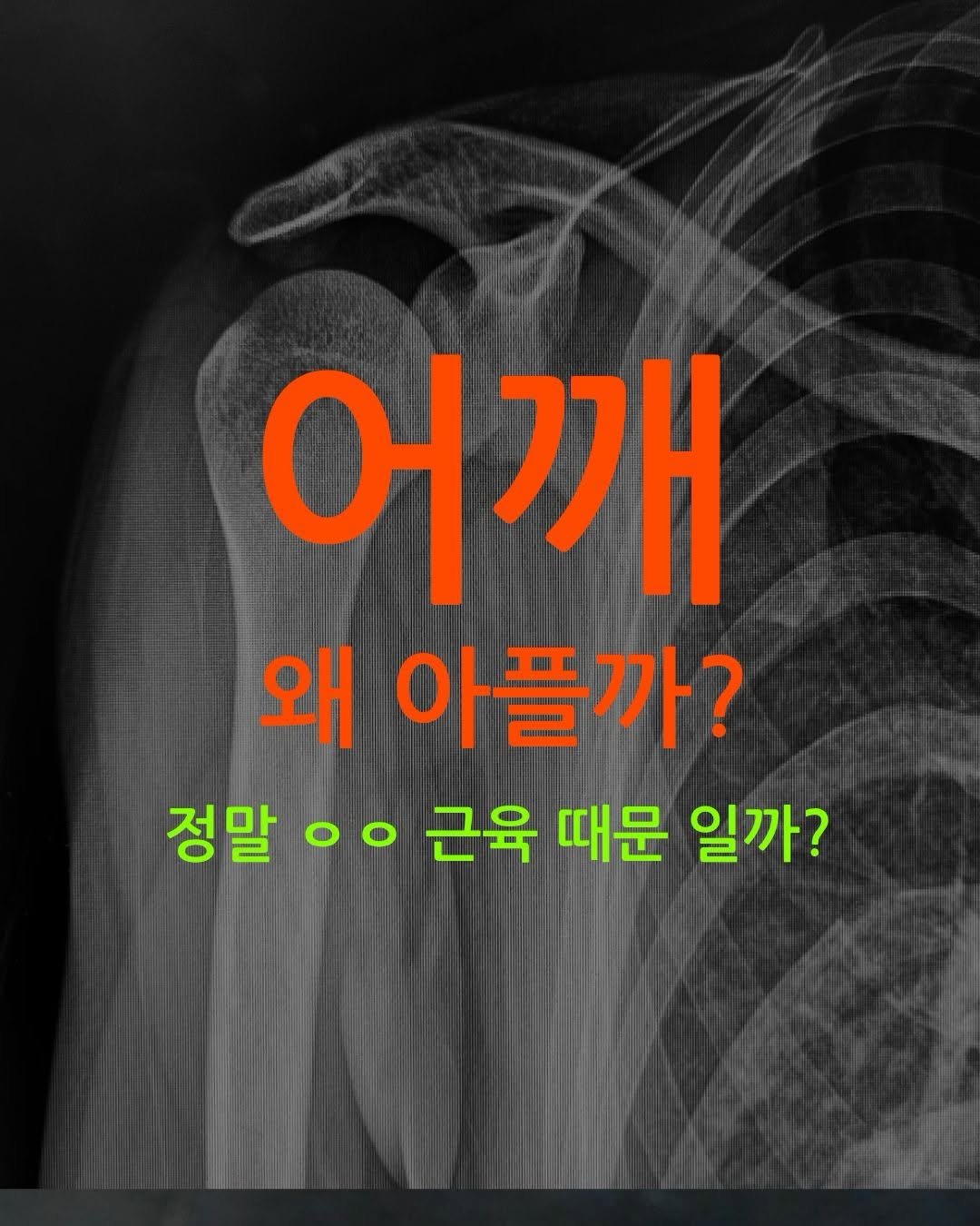 Photo shared by 섭쿠_어려운걸 쉽게 알려주는 사람 on March 10, 2026 tagging @weaponmasterlee, and @ujangsan_basecamp. May be an image of xray, bone, poster and text that says '어깨 깨 왜 아플까? 정말 정말ㅇㅇ oO 근육 때문 일까?'.