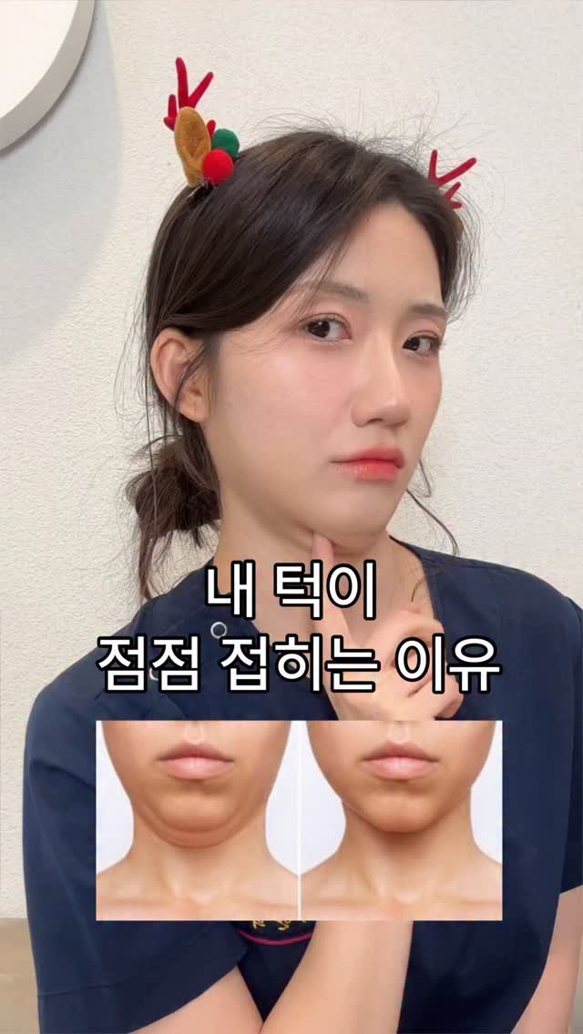 suface_hj 게시물 이미지: 제가 요즘 머리를 숙이는 자세로 오래 일 하다보니😫
목이 지속적으로 뻐근했는데...