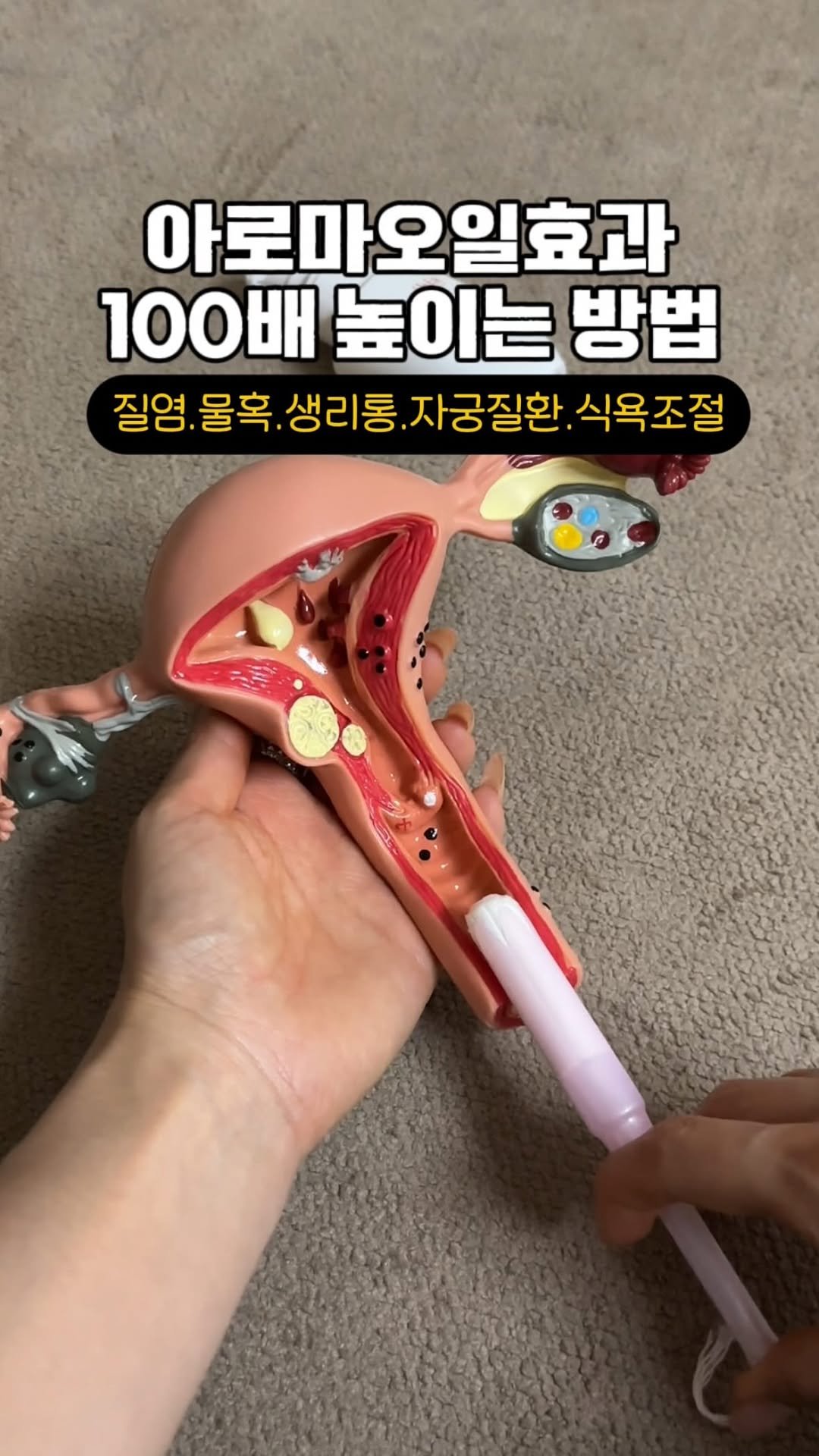 sunw_oo_ 게시물 이미지: 한의원 비밀 블랜딩레시피

자궁선근종.질염.분비물.생리혈
심하신분들은 궁오일뚜껑에...