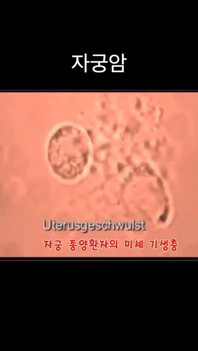 taebee333 게시물 이미지: 💡 암의 원인은 미세기생충
🇩🇪 Dr. Alphonse Weber 

🪱 모든...