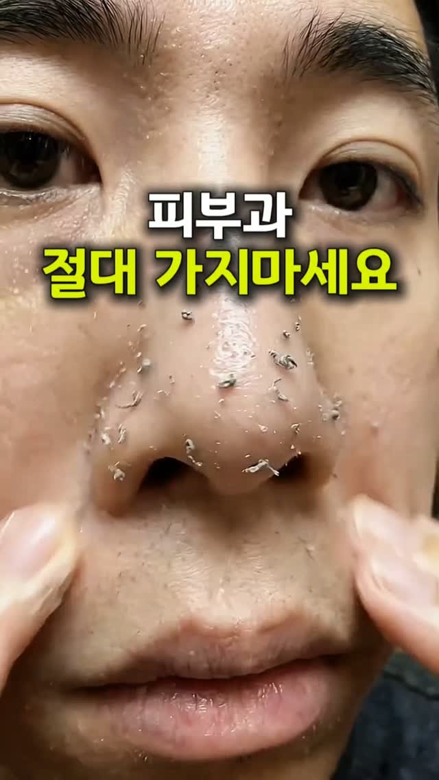 tem_salon 게시물 이미지: 💛 피부 까맣다면 이거 무조건 해보세요

10년 차 피부과 실장 친구가
거뭇거뭇한...