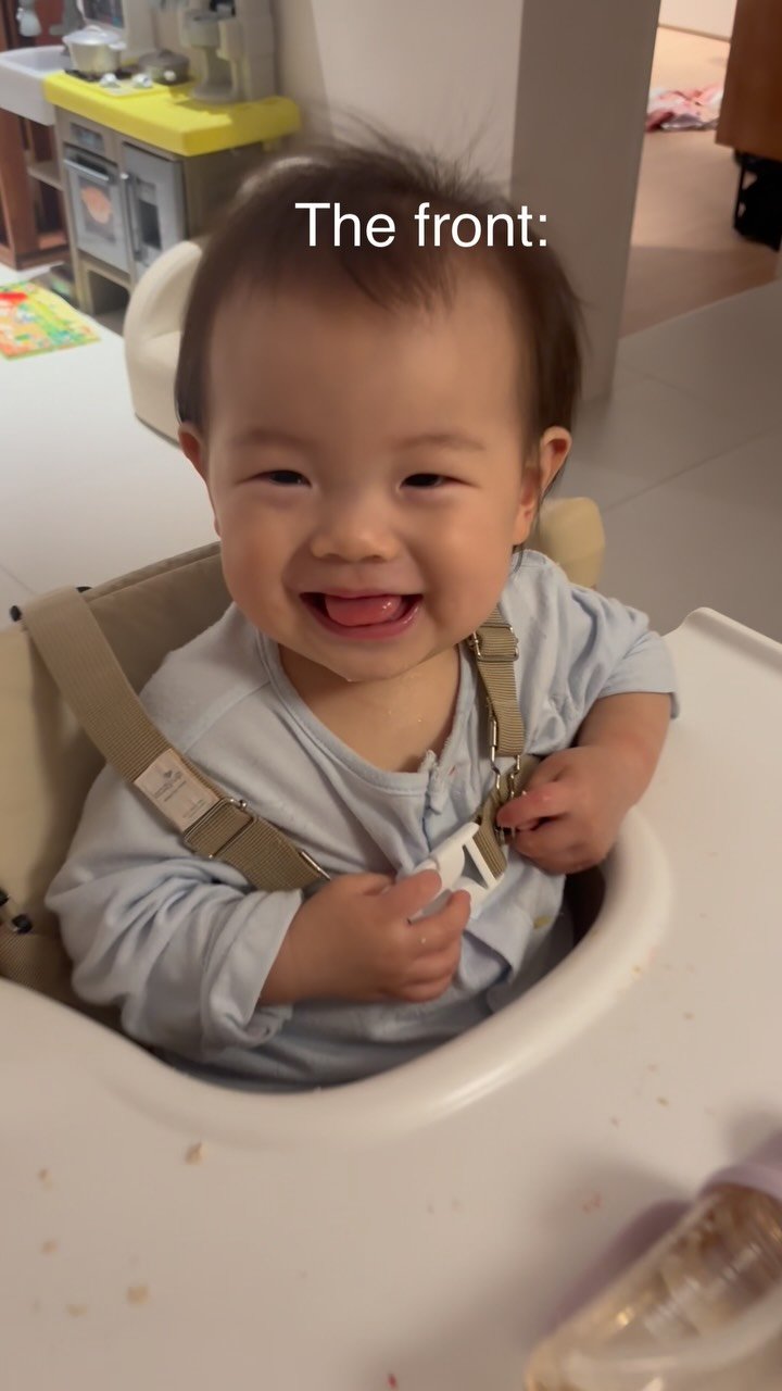 thank_u_girl 게시물 이미지: 고작 한 달 전인데 너무 애기애기하네 🥲👶🏻💕
쌀알 두 개 시절 땡큐 🦷🦷🤍