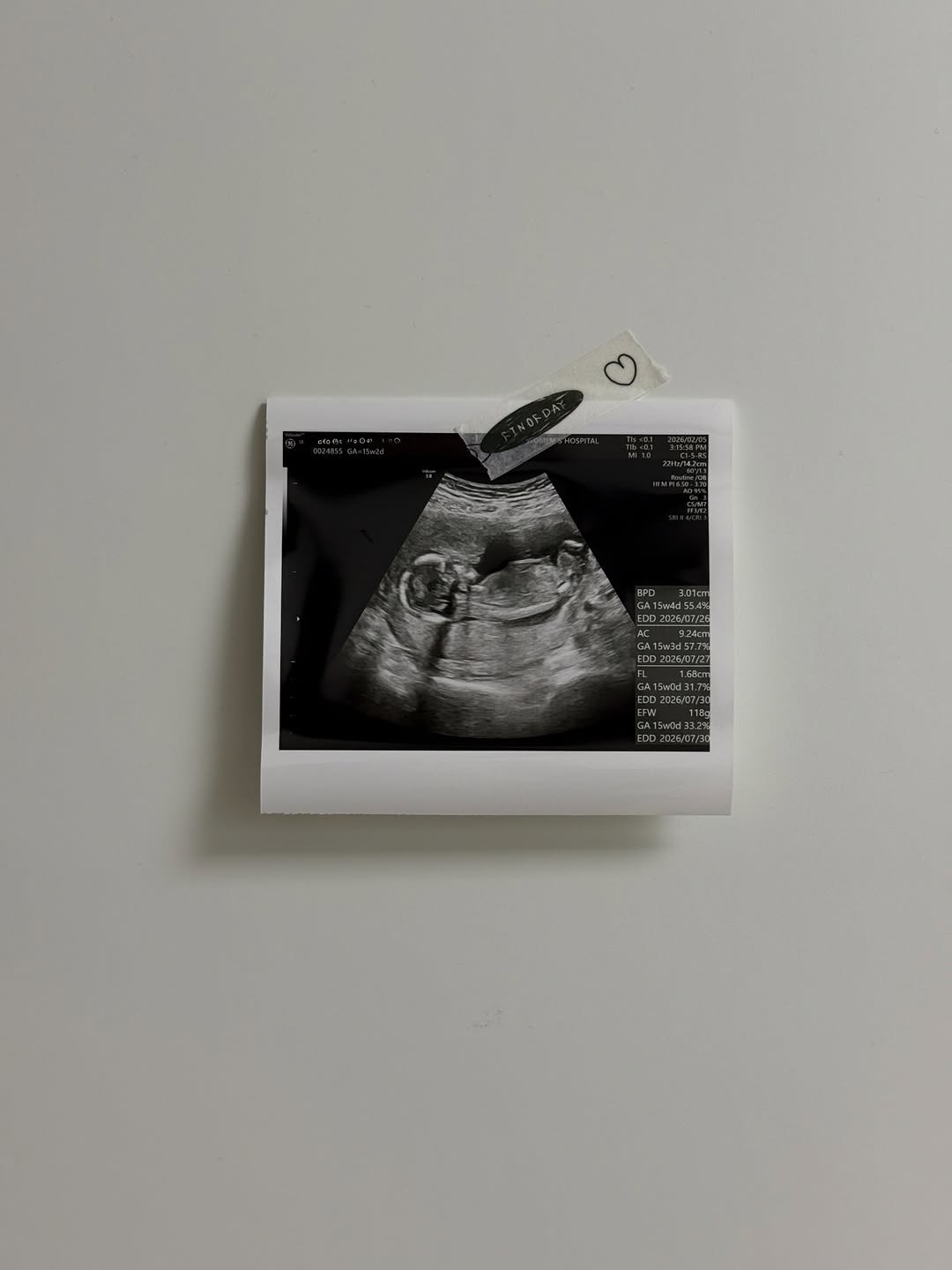 Photo shared by 더주니 ᴛʜᴇ.ᴊᴜɴɪ : 가려입자 날씬하게 on February 09, 2026 tagging @the_juni_. May be an image of xray and text.