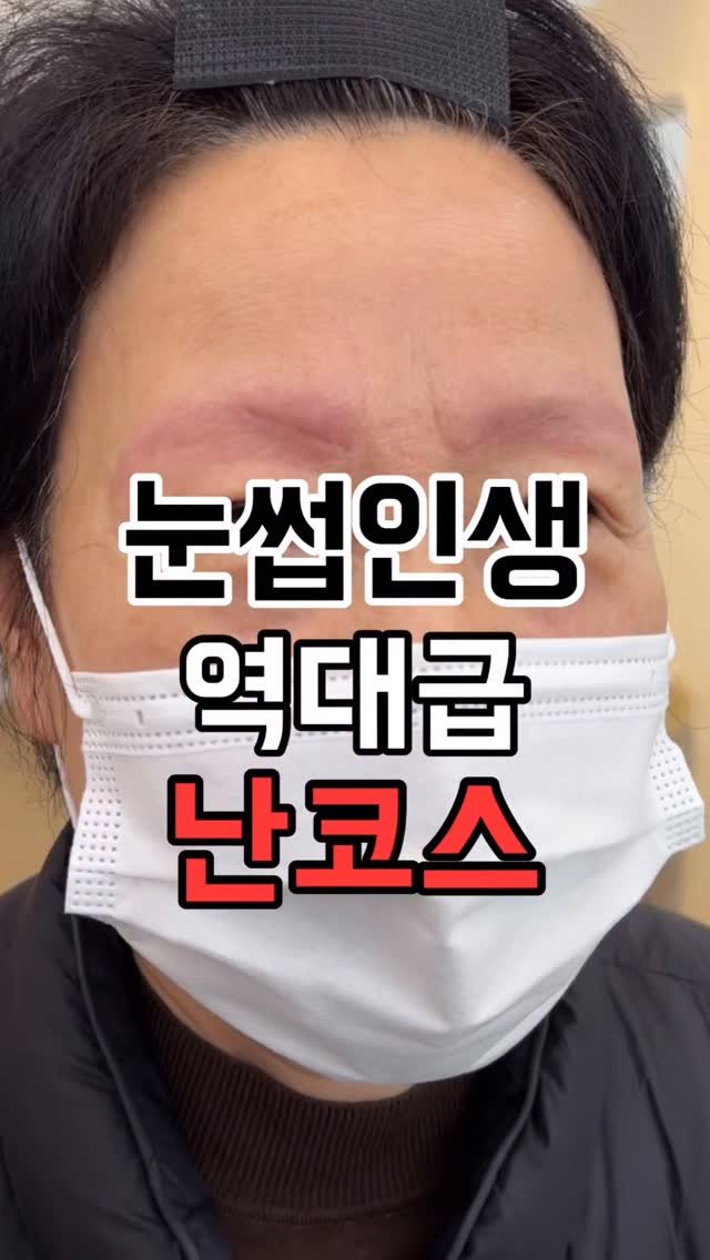 thebomm_beauty 게시물 이미지: 눈썹인생 최대 난코스를 만났습니다😮
이런 눈썹은 예전에 중국에서 몇번 본적이...