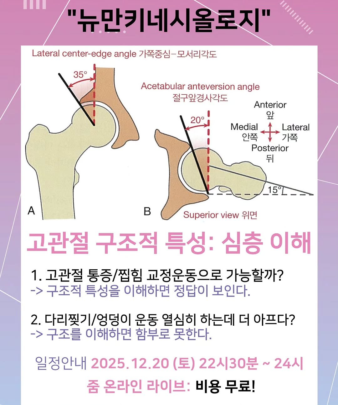 Photo by (주)더올바른필라테스 on December 20, 2025. May be an image of text that says 'Lateral center-edge angle 가쪽중심- 가족중심-모서리각도 모서리각도 유만키네시올로지" 35° Acetabular anteversion angle 절구앞경사각도 20° Anterior 앞 Medial Lateral 안쪽 가쪽 Posterior 뒤 A B Superior view 위면 고관절 구조적 특성: 심층 이해 1. 고관절 통증/찝힘 교정운동으로 가능할까? 구조적 특성을 이해하면 정답이 보인다. 2. 다리찢기/엉덩이 엉덩이 운동 열심히 하는데 더 아프다? -> 구조를 이해하면 함부로 못한다. 일정안내 2025. 25.12.20 (토) 22시30분 줌 온라인 라이브: 비용 무료! 24시'.