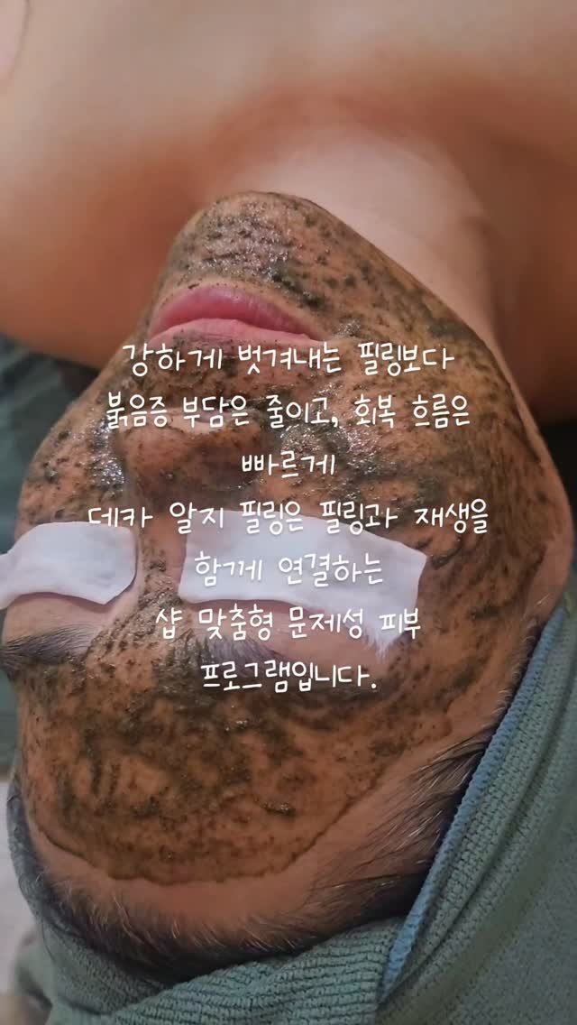 tinalab_c 게시물 이미지: 강하게 벗겨내는 필링보다
이제는 피부가 회복되는 흐름까지 봐야 합니다.

데카 알지...