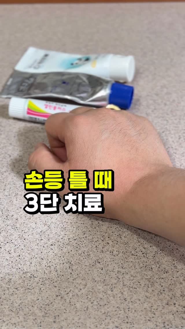 toad_pharm 게시물 이미지: 손등 틀때 핸드크림만 계속 바르셨나요?
⠀
⠀
✅ 핸드크림 사용전 -> 항진균제
✅...