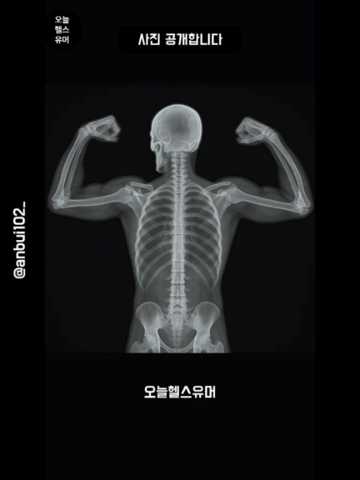 today_health_humor 게시물 이미지: 엑스레이를 찍으러 갔는데 간호사가 너무 예뻐서 제일 잘 하는 걸...