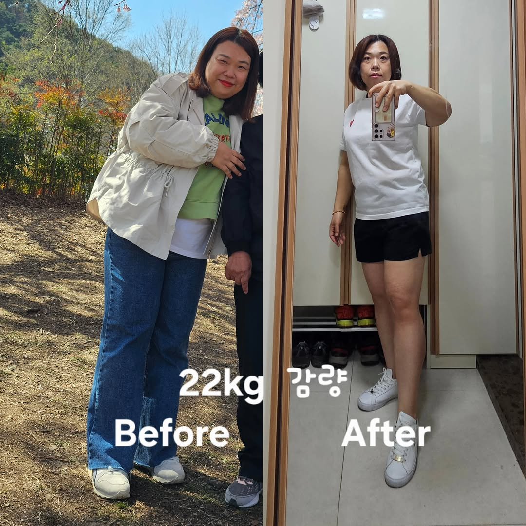 tory_jeong0306 게시물 이미지: 22kg 감량한 40대 아줌마
1년째 유지중