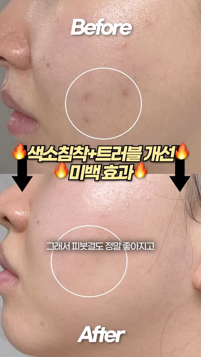 toxin1204 게시물 이미지: 💗올해 마지막 찬스! 아누아 X 톡신 3차 마켓💗
📌 구매처 : 12/22(월)...