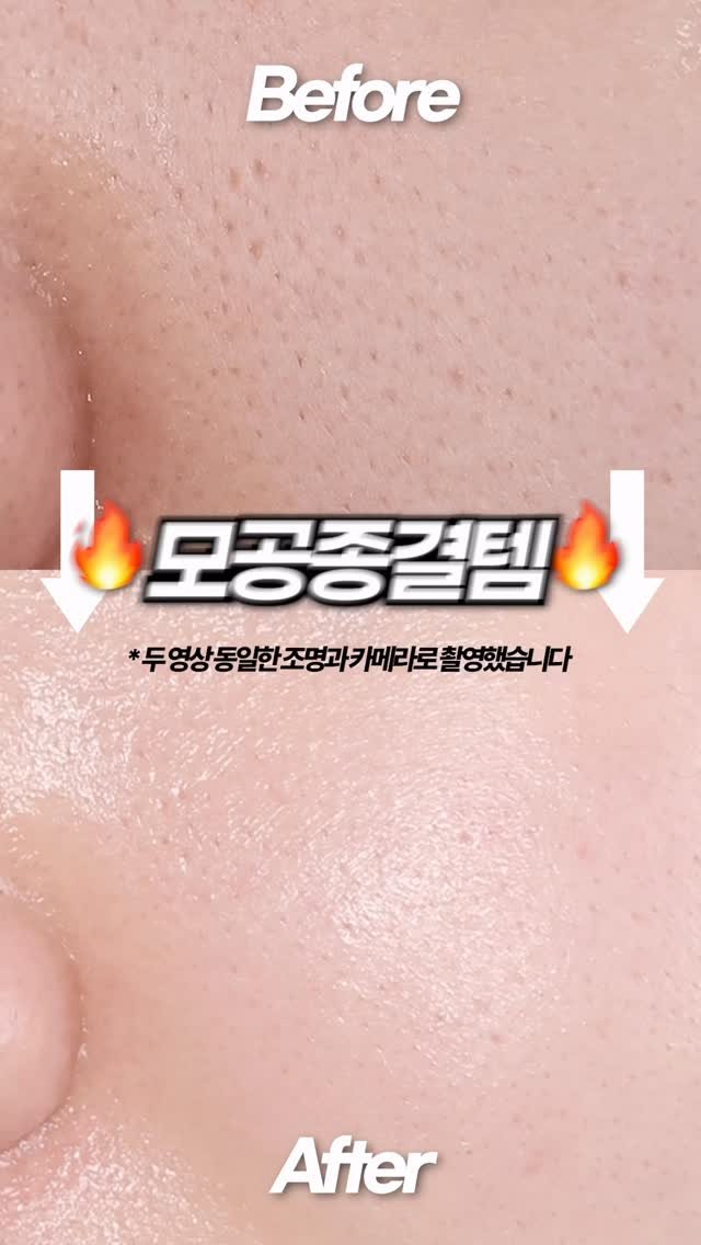 toxin1204 게시물 이미지: 피부 좋아지려면 무조건 발라야 하는 성분인 ⭐️레티노이드⭐️
제가 무조건 추천드리는...